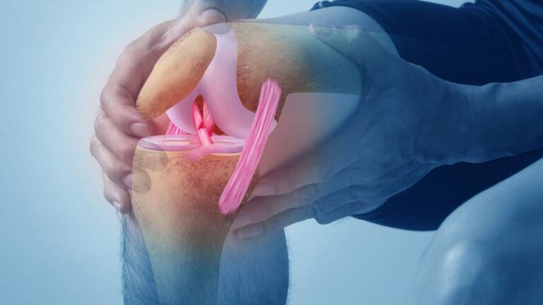 ACL Ruptures