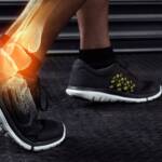 Ankle Arthritis