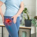 Hip Arthritis