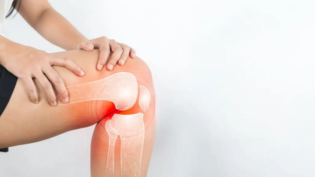 Knee Arthritis