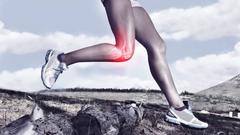 Runner’s Knee (Patellofemoral Pain)